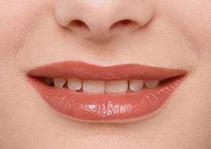 堺市のインプラント治療でどこにするか